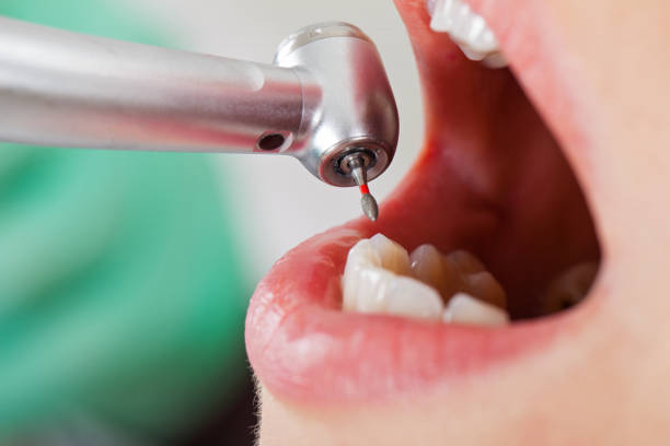 Best Emergency Dental Surgery in Humboldt, KS